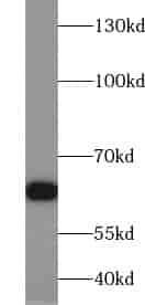 Anti-ZKSCAN1 antibody - Click Image to Close