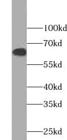 Anti-ZKSCAN3 antibody - Click Image to Close