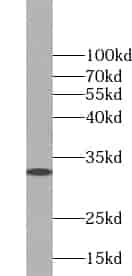 Anti-ZMAT3 antibody - Click Image to Close