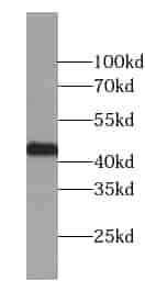 Anti-ZMYND12 antibody - Click Image to Close