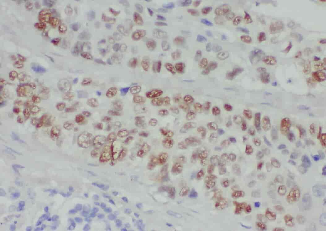 Anti-ZMYND8 antibody - Click Image to Close