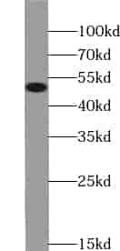 Anti-ZNF134 antibody - Click Image to Close