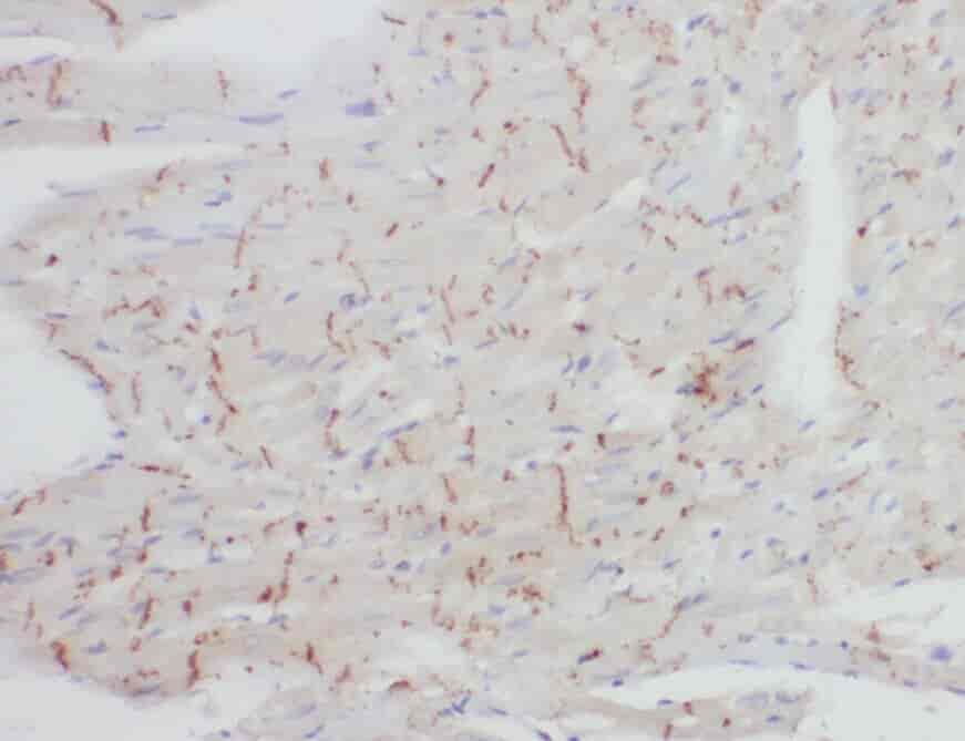 Anti-ZNF146 antibody - Click Image to Close