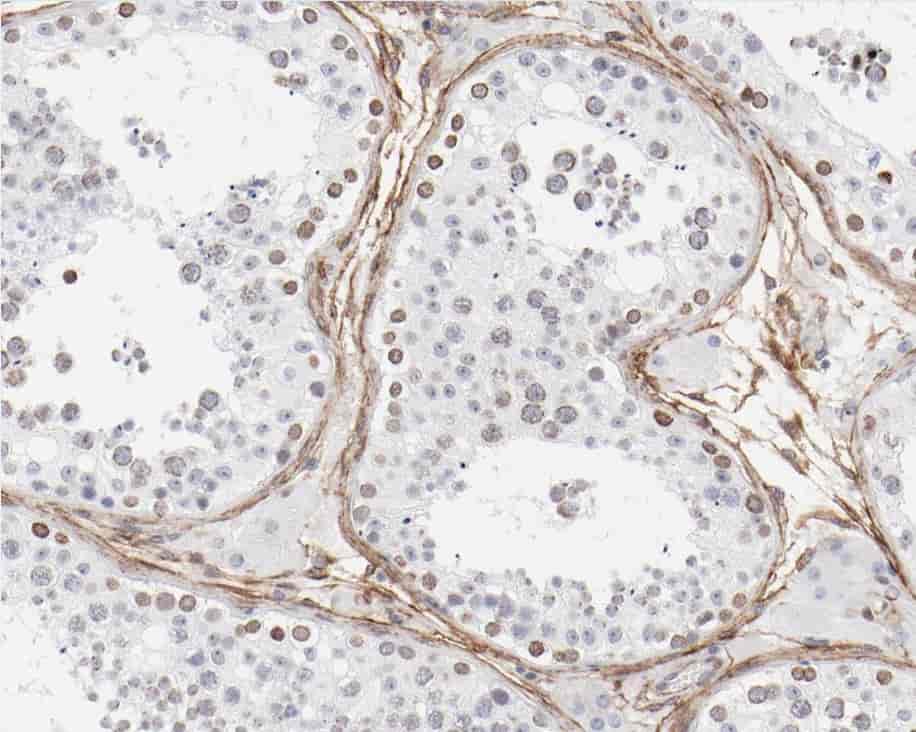 Anti-ZNF174 antibody - Click Image to Close