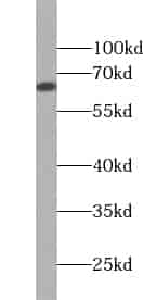 Anti-ZNF192 antibody - Click Image to Close