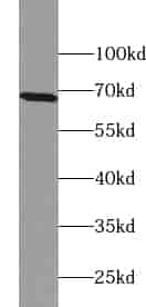 Anti-ZNF211 antibody - Click Image to Close