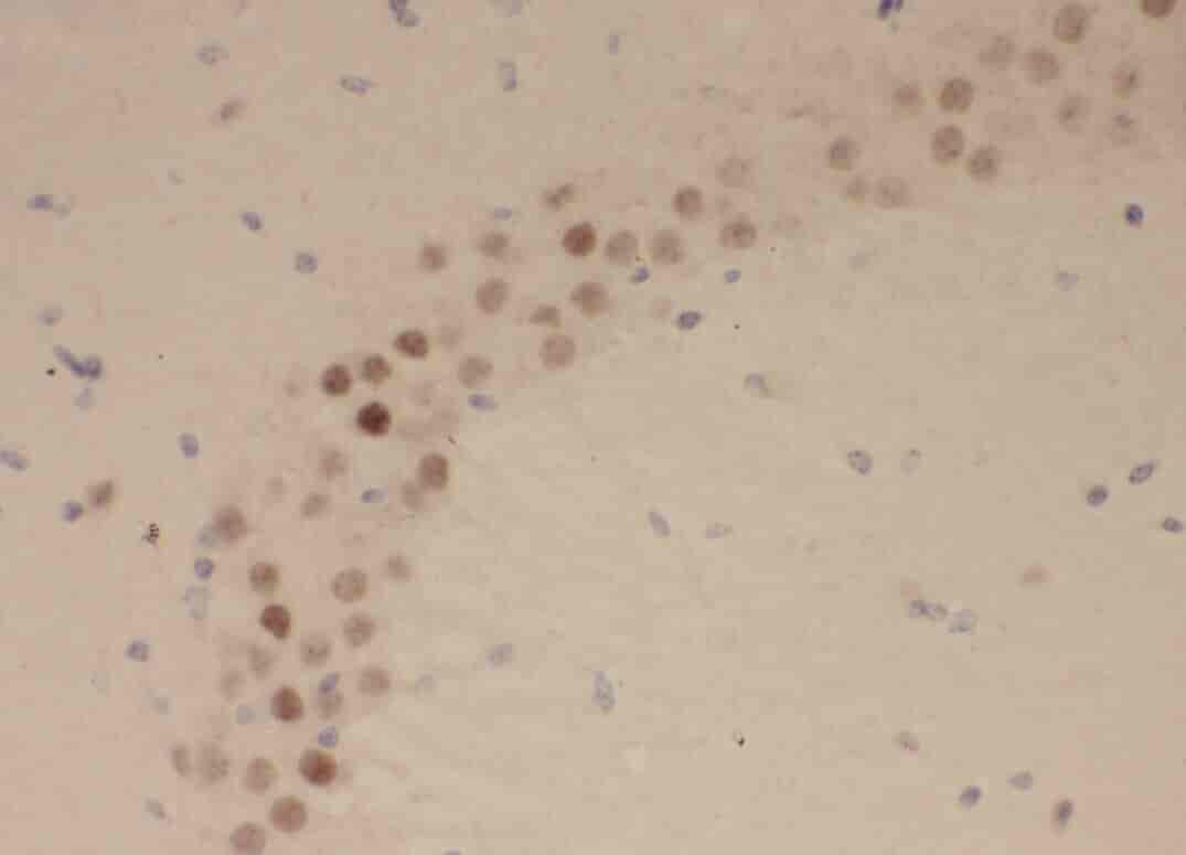 Anti-ZNF238 antibody - Click Image to Close