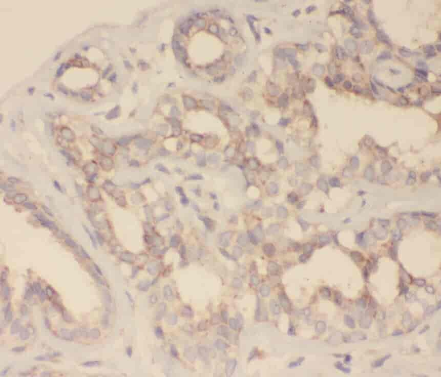 Anti-ZNF24 antibody - Click Image to Close