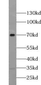 Anti-ZNF251 antibody - Click Image to Close