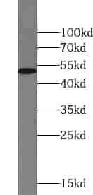 Anti-ZNF256 antibody - Click Image to Close