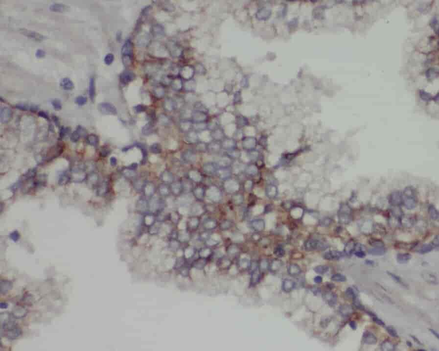 Anti-ZNF266 antibody - Click Image to Close