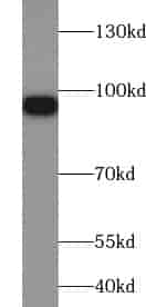 Anti-ZNF287 antibody - Click Image to Close