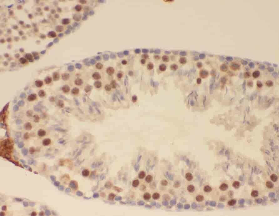 Anti-ZNF311 antibody - Click Image to Close