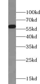 Anti-ZNF35 antibody