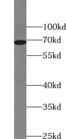 Anti-ZNF354A antibody - Click Image to Close