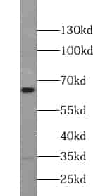 Anti-ZNF394 antibody - Click Image to Close