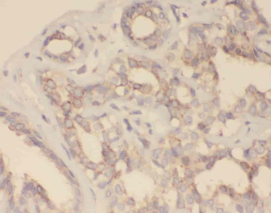 Anti-ZNF395 antibody - Click Image to Close