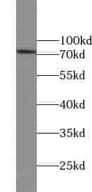 Anti-ZNF443 antibody - Click Image to Close