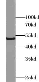 Anti-ZNF446 antibody - Click Image to Close