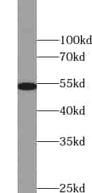 Anti-ZNF486 antibody