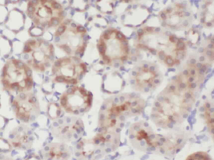 Anti-ZNF497 antibody - Click Image to Close
