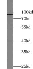 Anti-ZNF509 antibody - Click Image to Close