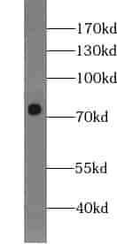 Anti-ZNF549 antibody - Click Image to Close