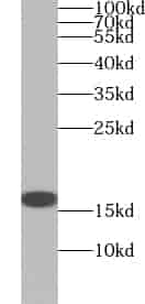 Anti-ZNF593 antibody - Click Image to Close