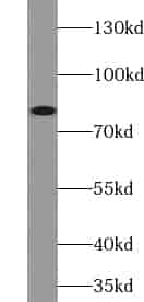 Anti-ZNF600-Specific antibody - Click Image to Close
