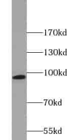 Anti-ZNF606 antibody - Click Image to Close
