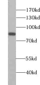 Anti-ZNF611 antibody