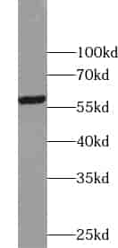 Anti-ZNF649 antibody - Click Image to Close