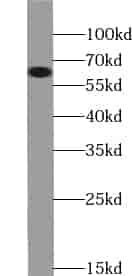 Anti-ZNF671 antibody - Click Image to Close