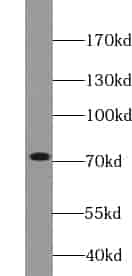 Anti-ZNF695 antibody - Click Image to Close