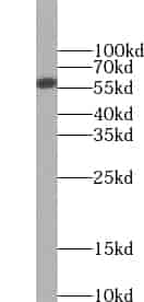 Anti-ZNF703 antibody - Click Image to Close
