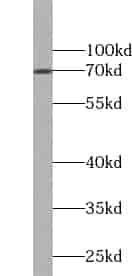 Anti-ZNF74 antibody - Click Image to Close