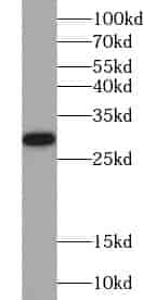 Anti-ZNF740 antibody - Click Image to Close