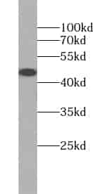 Anti-ZNF763 antibody