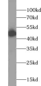 Anti-ZNF785 antibody - Click Image to Close