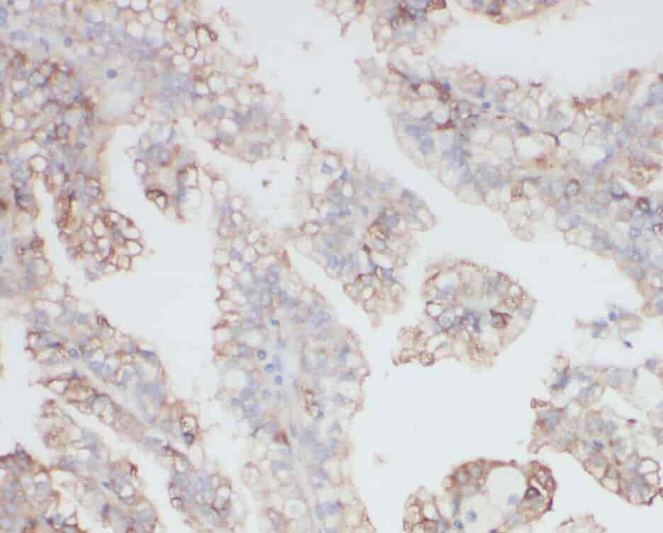 Anti-ZNF839 antibody