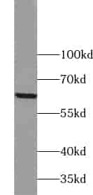 Anti-ZNF846 antibody - Click Image to Close