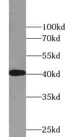 Anti-ZP3 antibody - Click Image to Close