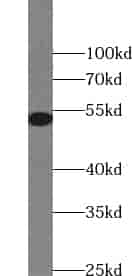 Anti-ZSCAN21 antibody - Click Image to Close
