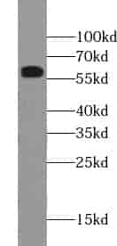 Anti-ZSCAN5A antibody - Click Image to Close
