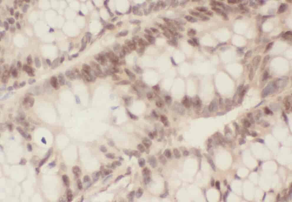 Anti-ZWILCH antibody - Click Image to Close