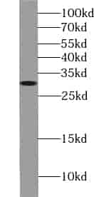 Anti-ZWINT antibody - Click Image to Close