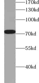 Anti-ZXDC antibody - Click Image to Close
