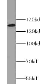 Anti-ZZZ3 antibody - Click Image to Close