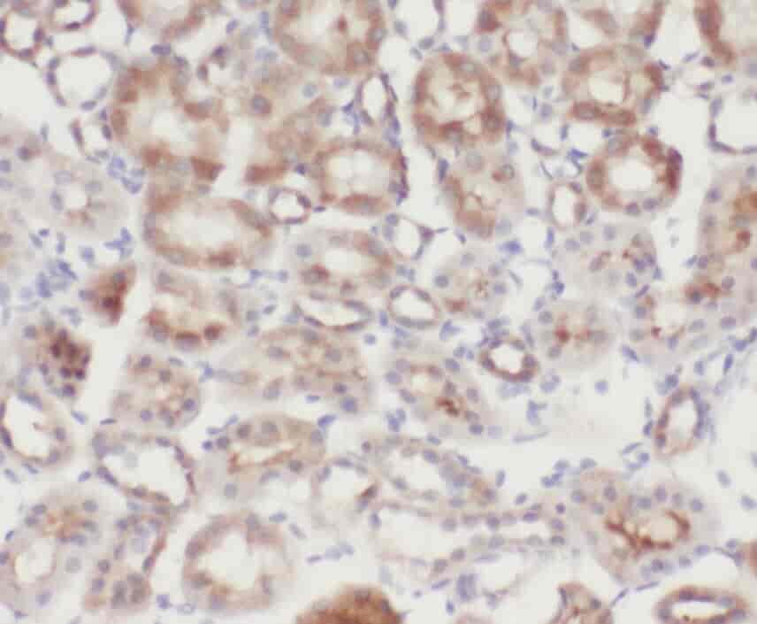 Anti-Zyxin antibody - Click Image to Close