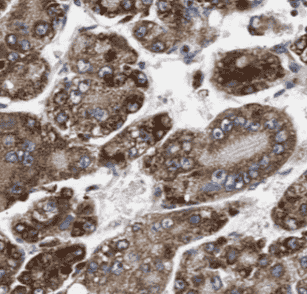 Anti-liver Arginase antibody - Click Image to Close